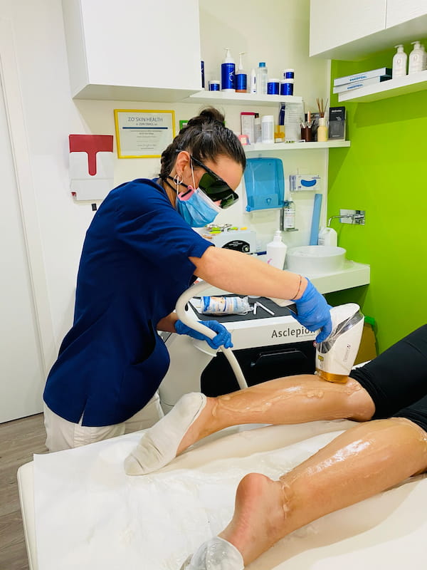Epilazione laser viso e corpo 